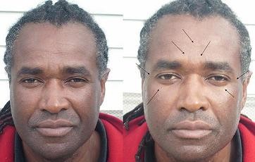 Other: Faces